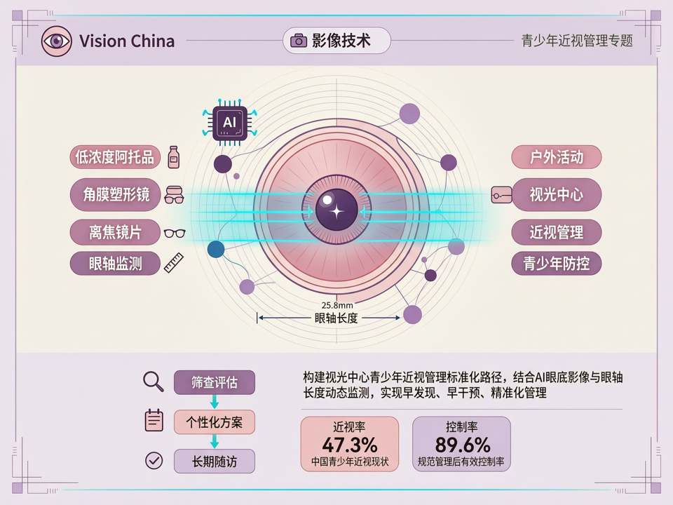 AI眼底影像与眼轴监测:构建视光中心青少年近视管理标准化路径